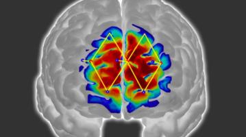 Pain prediction scan