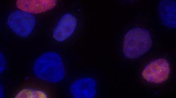 Fizbein alternative splicing